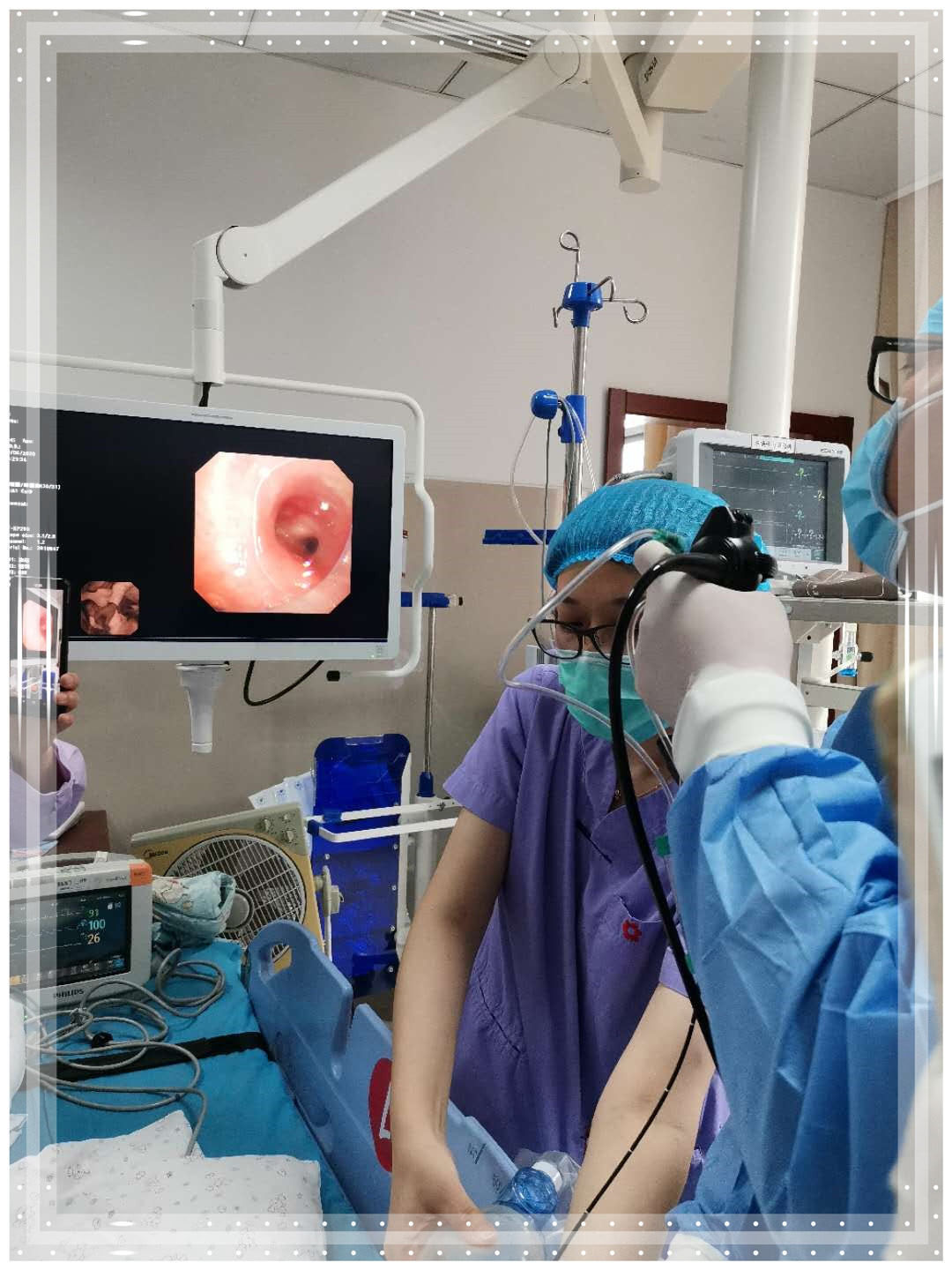 纤维支气管镜可视软性喉镜气管插管镜麻醉视频喉镜-阿里巴巴