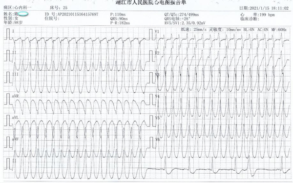 1.熊奶奶的心电图.jpg