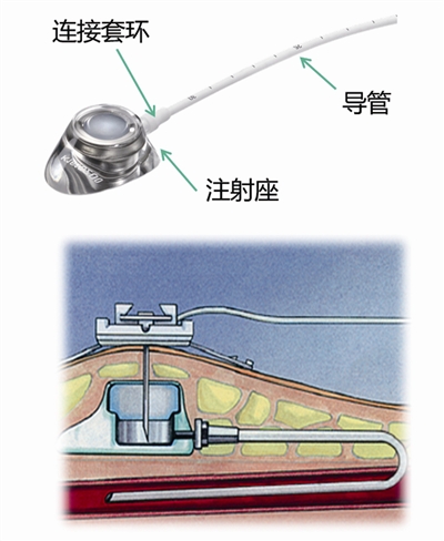 1101_b.jpg 1101_b.jpg